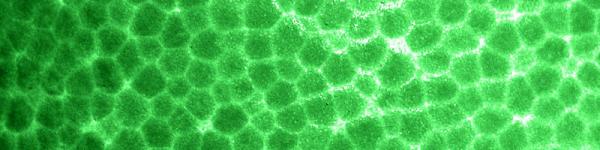 20090118 green foam pattern