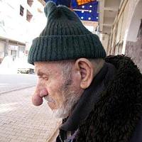 درازترین بینی جهان