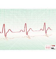 heart beat grid vector