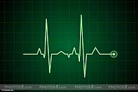ekg heart rate pulse sjpg428